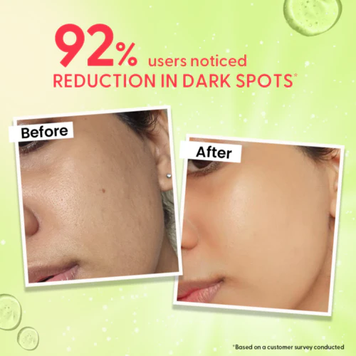 Outshine Korean Face Serum – Fades Dark Spots & Brightens Skin with Glutathione, Niacinamide & Vitamin C - Image 4